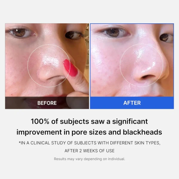 MEDICUBE - ZERO PORE PAD 155g - Image 4
